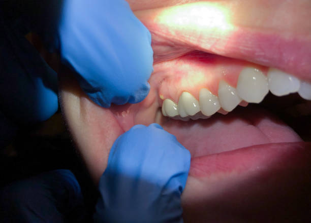 Best Emergency Treatment for Jaw Pain or Injury in Morgandale, OH