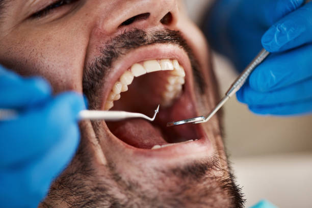 Best Broken or Chipped Tooth Repair in Morgandale, OH